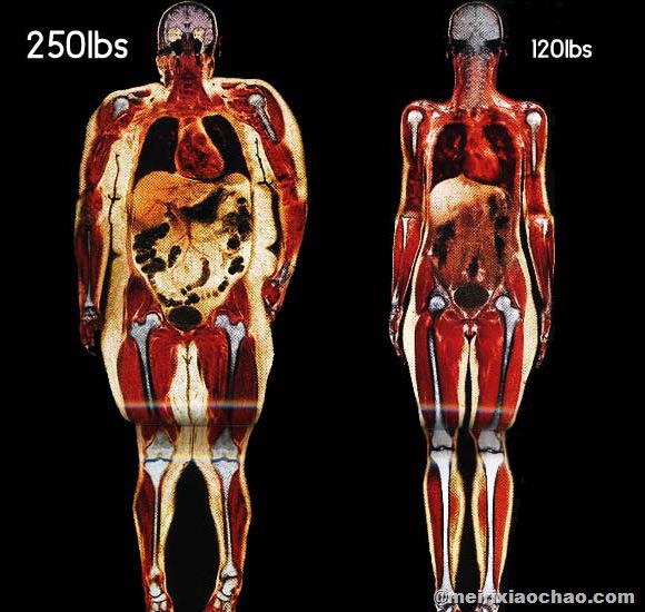 BodyScansoftwoWomen250lbvs120lb.jpg